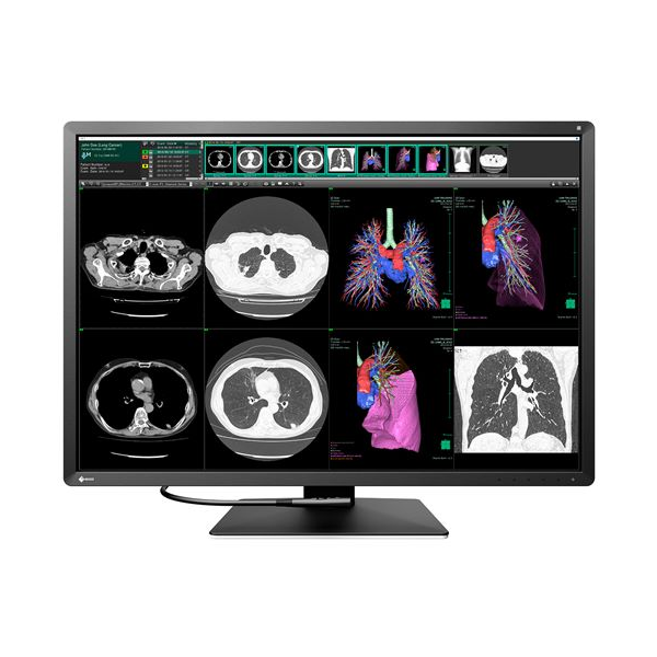 Ecran Eizo Radiforce RX 1270, 12MP Ecran Eizo Radiforce RX 1270, 12MP
