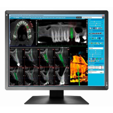 Ecran Eizo MX 217-SB Radioforce 21,3