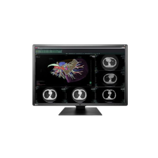 Ecran Eizo Radiforce RX 660, 6MP