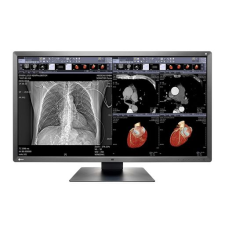 Ecran Eizo MX 243W Radioforce 24,1"